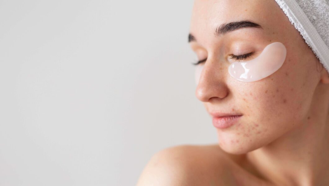 Acne Patches How They Work & Why Amazon is Best to Buy.